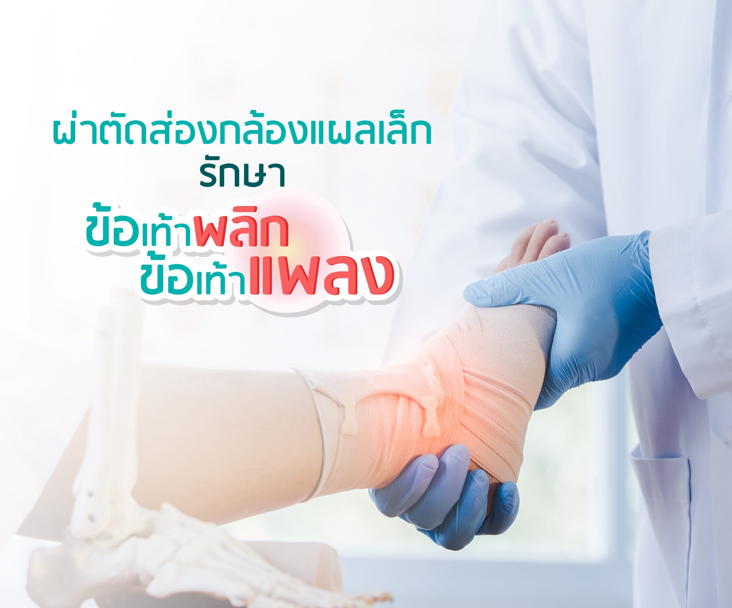 ข้อเท้าพลิก ข้อเท้าแพลง ข้อเท้าพลิก ข้อเท้าแพลง